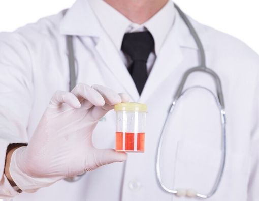 Pertolongan Pertama Saat Menemukan Darah di Urine