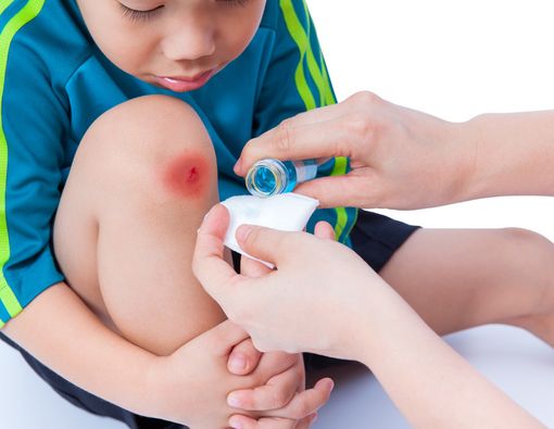 Tips Perawatan Luka Ringan di Rumah