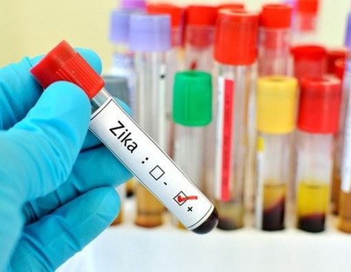 Pemeriksaan Darah untuk Mengetahui Virus Zika