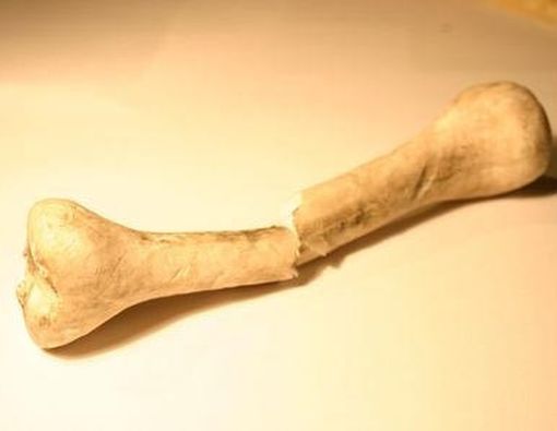 Kunci Mencegah Patah Tulang pada Penyandang Osteoporosis 