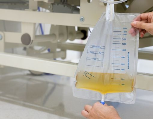 Fungsi dan Cara Kerja Alat Kateter Urine