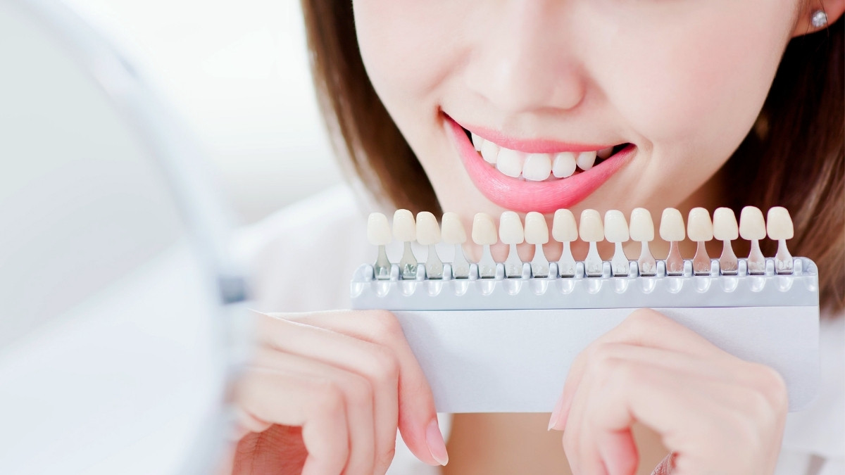 Veneer Gigi Bisa Menyebabkan Gusi Berdarah, Benarkah