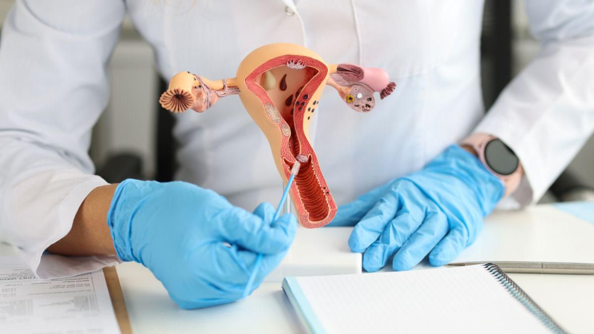 3 Pilihan Operasi Kista Bartholin