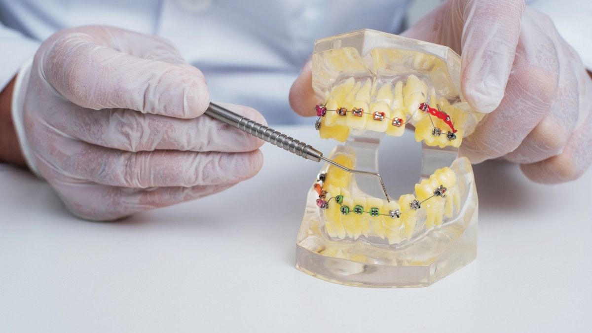 Mengenal Dokter Gigi Spesialis Ortodonti dan Perannya