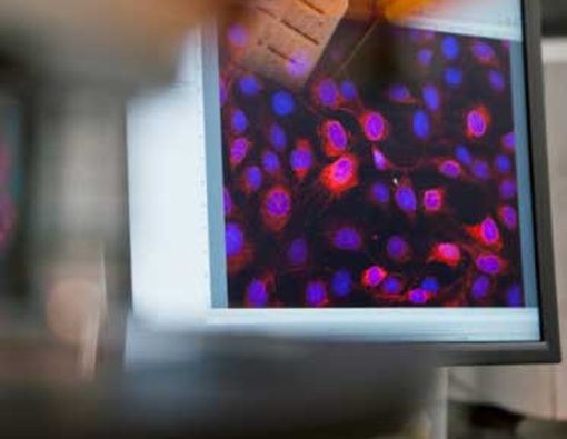 Regenerasi Sel Otak dari Sel Kulit: Harapan Penderita Stroke