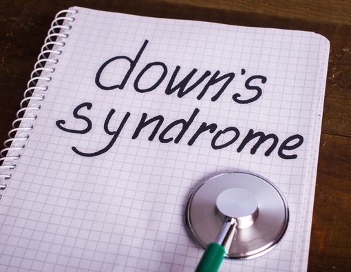Komplikasi yang Sering Terjadi pada Anak Down Syndrome