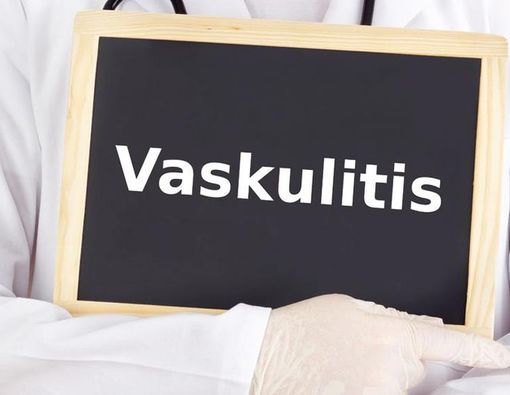 Mengenal Penyakit Radang Pembuluh Darah