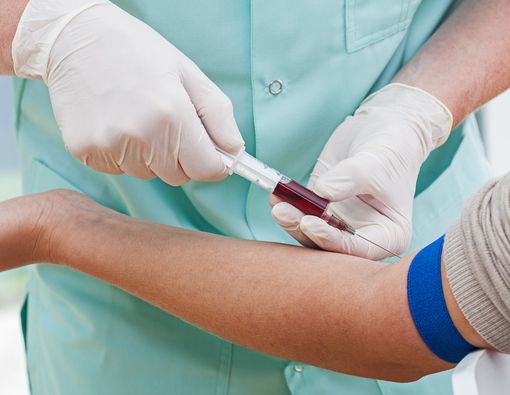 Deteksi Penyakit Alzheimer dengan Tes Darah, Mungkinkah?