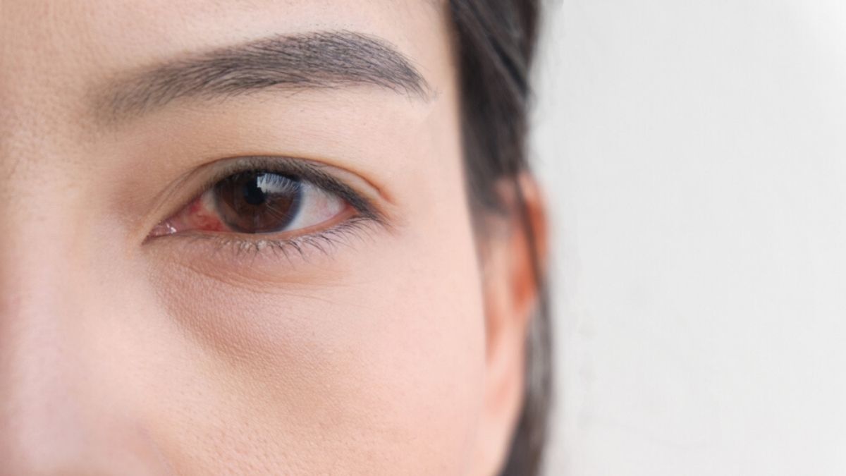4 Kebiasaan yang Bisa Menjadi Penyebab Ablasi Retina