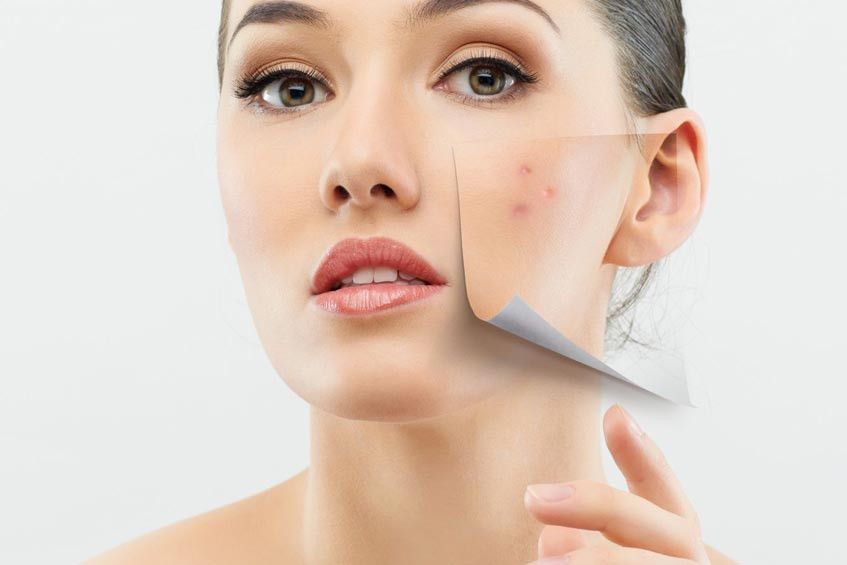 Kulit Anda Sensitif? Mungkin Ini Sebabnya