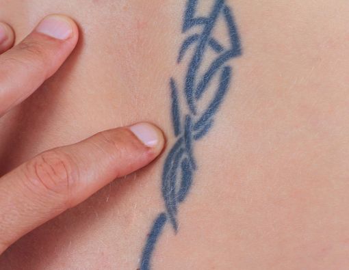 Efek Tato Terasa Gatal, Kenapa, Ya?