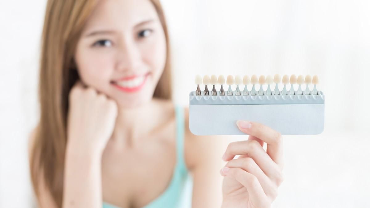 Veneer Gigi Bisa Tahan Berapa Lama? Ini Faktanya