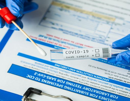 Fakta atau Hoaks Hasil Rapid Test Reaktif Bila Anda Sedang Flu?