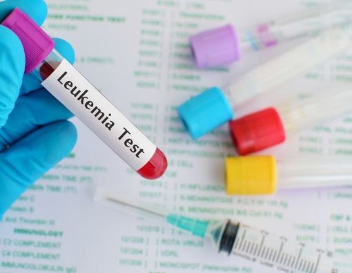 Deteksi Dini Leukemia, Bisakah Dilakukan?
