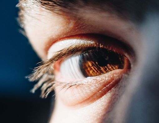 Gejala dan Cara Mengatasi Herpes Mata