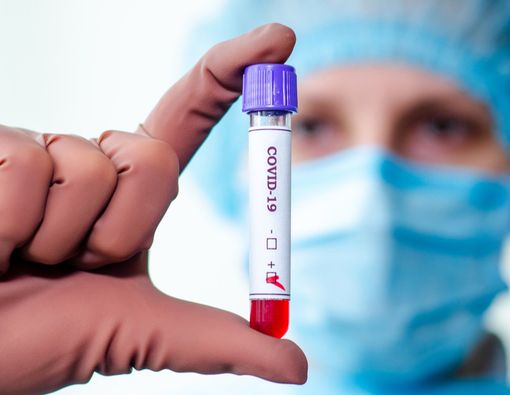 COVID-19 Jadi Nama Baru Coronavirus, Ini Update Terbarunya!