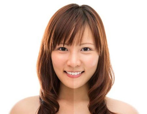 Mengapa Kulit Menghitam?