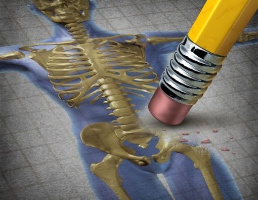 Semakin Jarang Bergerak, Tulang Keropos