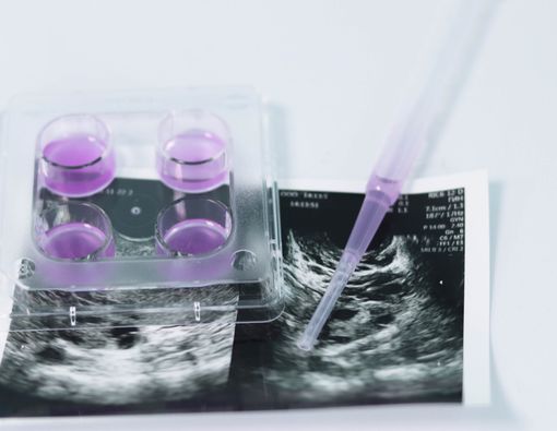 Penyebab Program Bayi Tabung Gagal