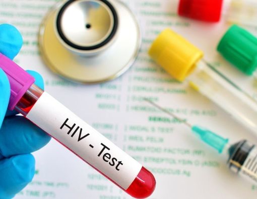 Peneliti Temukan HIV Jenis Baru, Dinilai Lebih Infeksius