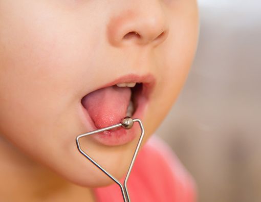 Si Kecil Masih Cadel? Ini Solusinya