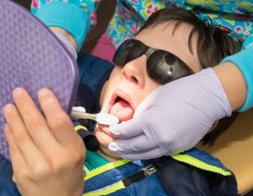 Pentingnya Menjaga Kesehatan Gigi Anak dengan Sindrom Down