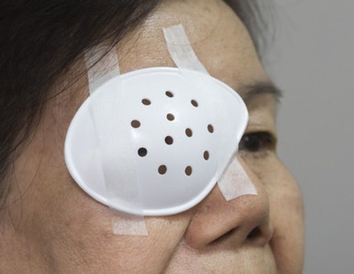 5 Penyakit Mata Penyebab Kebutaan