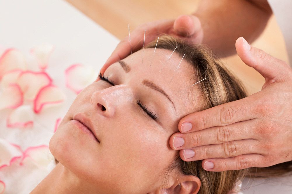 Mana Lebih Efektif Atasi Sakit Kepala, Akupunktur atau Akupresur?