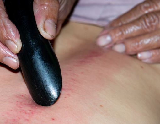 Kena Serangan Jantung Bolehkah Kerokan?