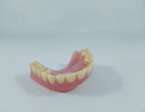 Alternatif Gigi Tiruan Permanen yang Aman