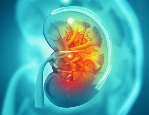 Kenali Gejala Penyakit Batu Ginjal dan Pencegahannya