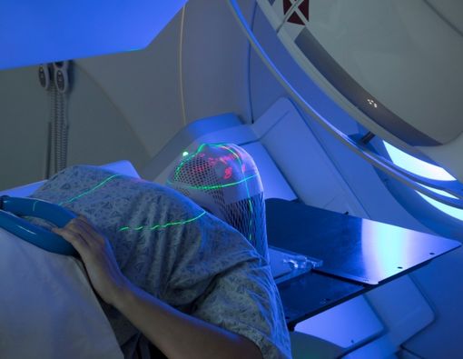 Cara Kemoterapi dan Terapi Radiasi Perlemah Daya Tahan Tubuh