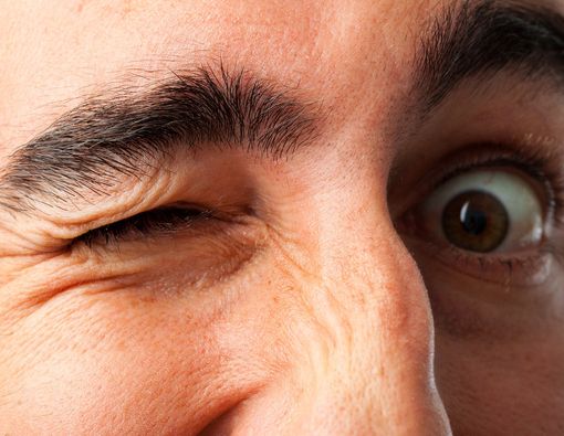 Kenali dan Waspadai Penyebab Mata Kedutan