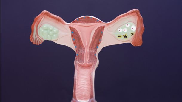 Sargish sochlar it uslubida sikilishmoqda (foto)