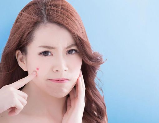 Bebas Jerawat Saat PMS