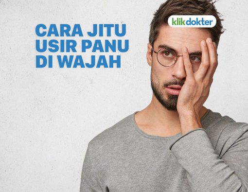 Cara Menghilangkan Panu di Wajah