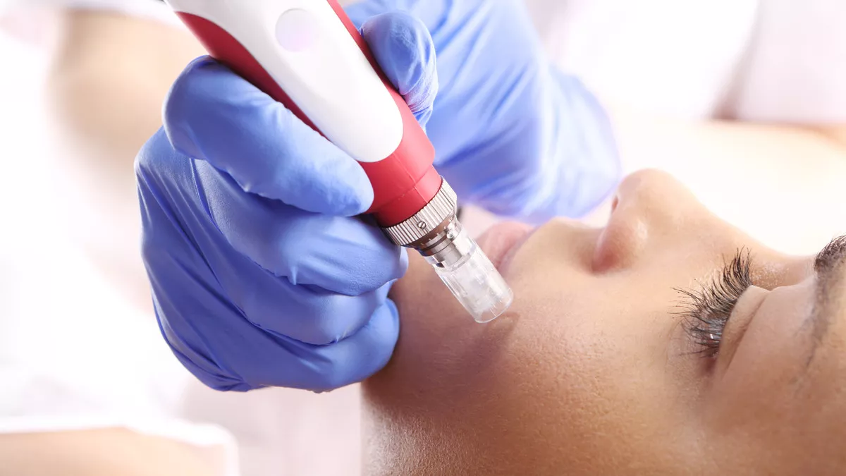 Mengenal Microneedling, Perawatan Wajah dengan Tusuk Jarum