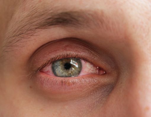 5 Masalah Kesehatan Ini Bisa Dideteksi dari Mata