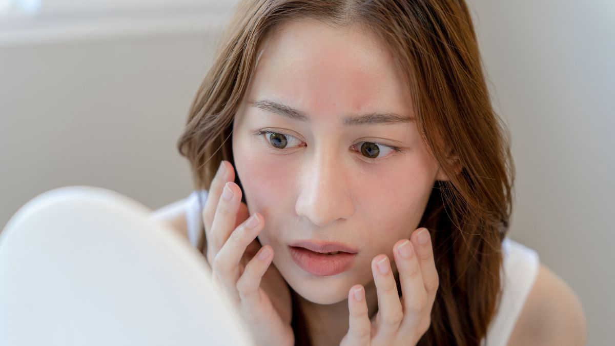 Cara Mengatasi Wajah Gatal dan Merah Karena Kosmetik