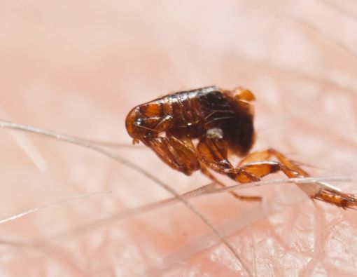 Waspada, Kutu Rambut Bisa Picu Serangan Jantung