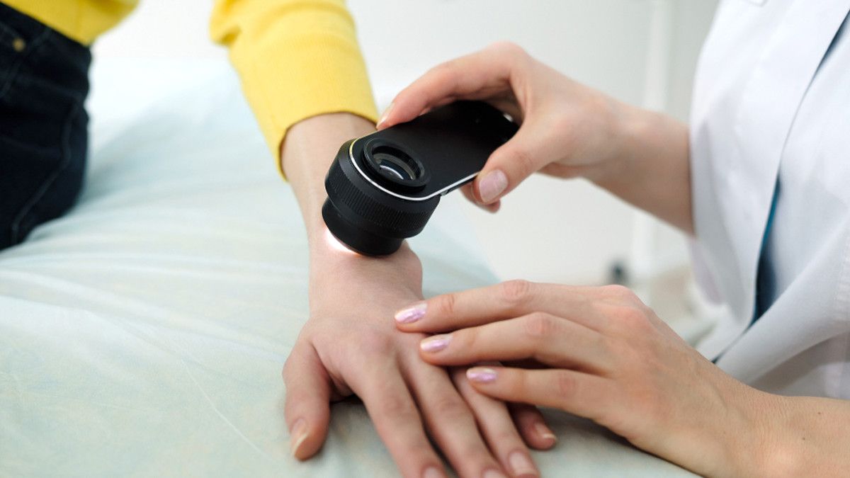 Ini Dia Penyakit yang Ditangani Dokter Spesialis Kulit dan Kelamin!