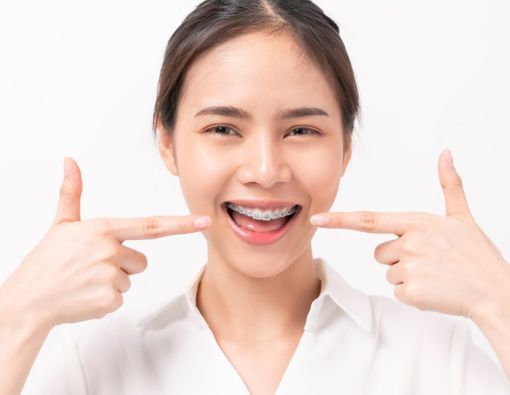 Bolehkah Gigi Palsu Dipasang Behel? Ini Kemungkinan Dampaknya