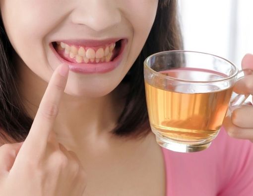 Makanan dan Minuman Ini Sebabkan Gigi Kuning