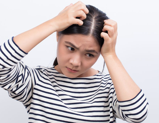 Daftar Obat Penghilang Kutu Rambut yang Ampuh