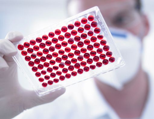 Pemeriksaan Darah yang Aman untuk Deteksi Dini Sindrom Down