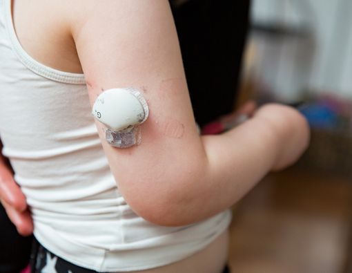 Mengapa Anak Kecil Bisa Terkena Diabetes Tipe 1?