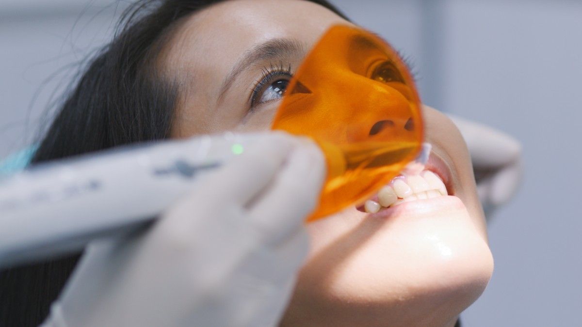 Apa yang Dimaksud dengan Restorasi Gigi?