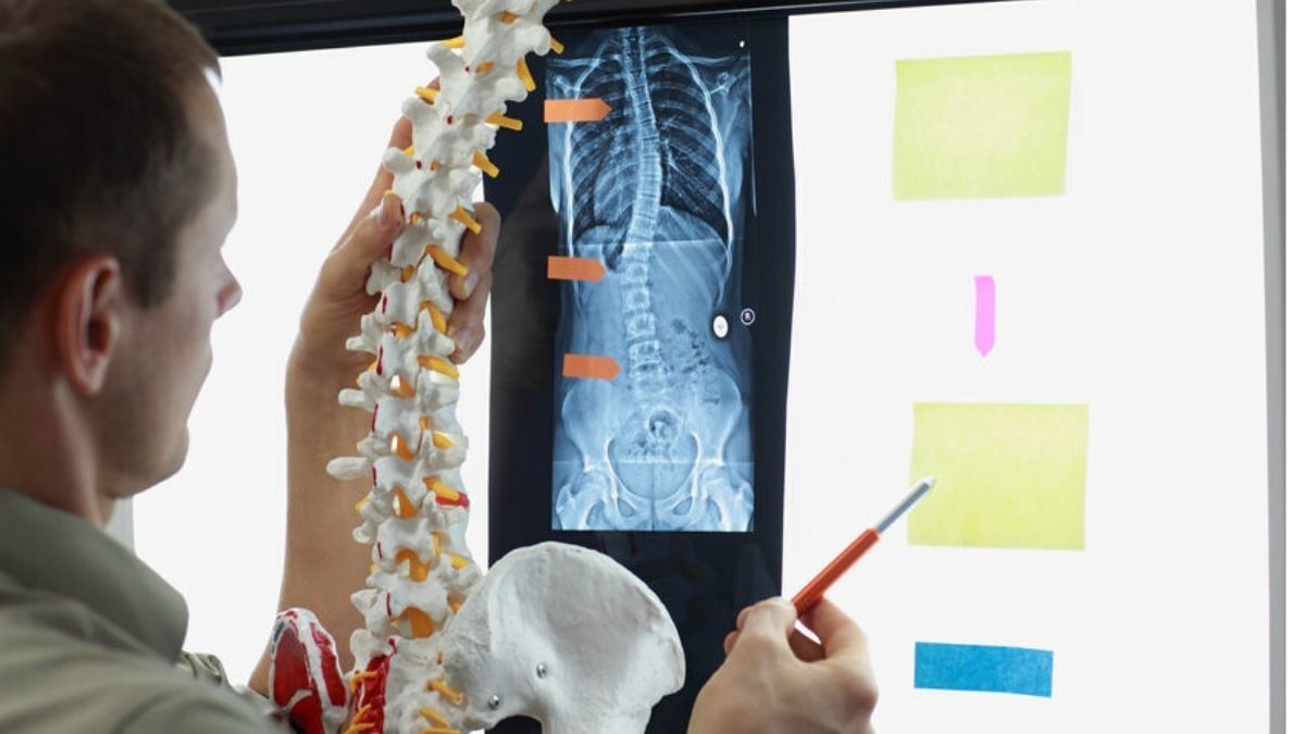 Apakah Kebiasaan Tertentu Bisa Jadi Penyebab Skoliosis?