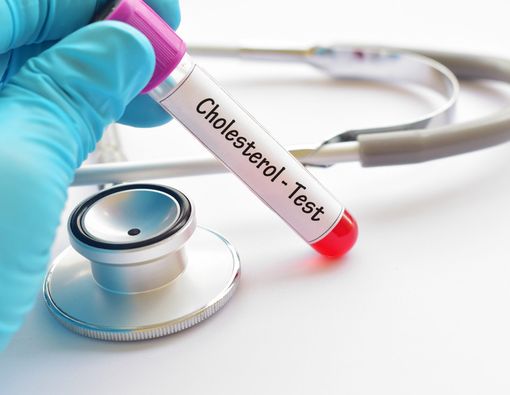 Ini Perbedaan Antara Trigliserida dan Kolesterol