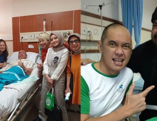 Tips Mencegah Kanker Otak, Penyakit yang Menaklukkan Agung Hercules